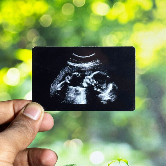Baby scan wallet card